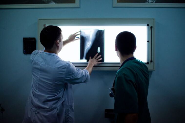 تشخيص التهاب المفاصل على X -ray